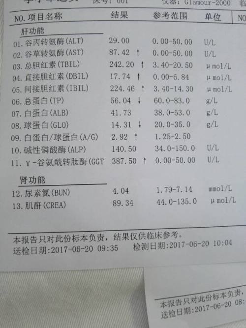 黄疸偏高检查肝功能看不懂求解